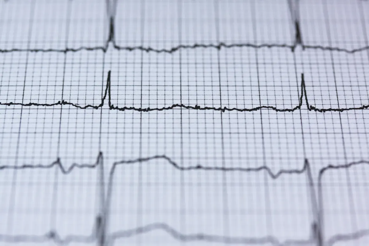 그림지 위에 있는 ECG 결과의 가까운 모습, 심장 리듬과 심박수 데이터를 위한 의료 분석